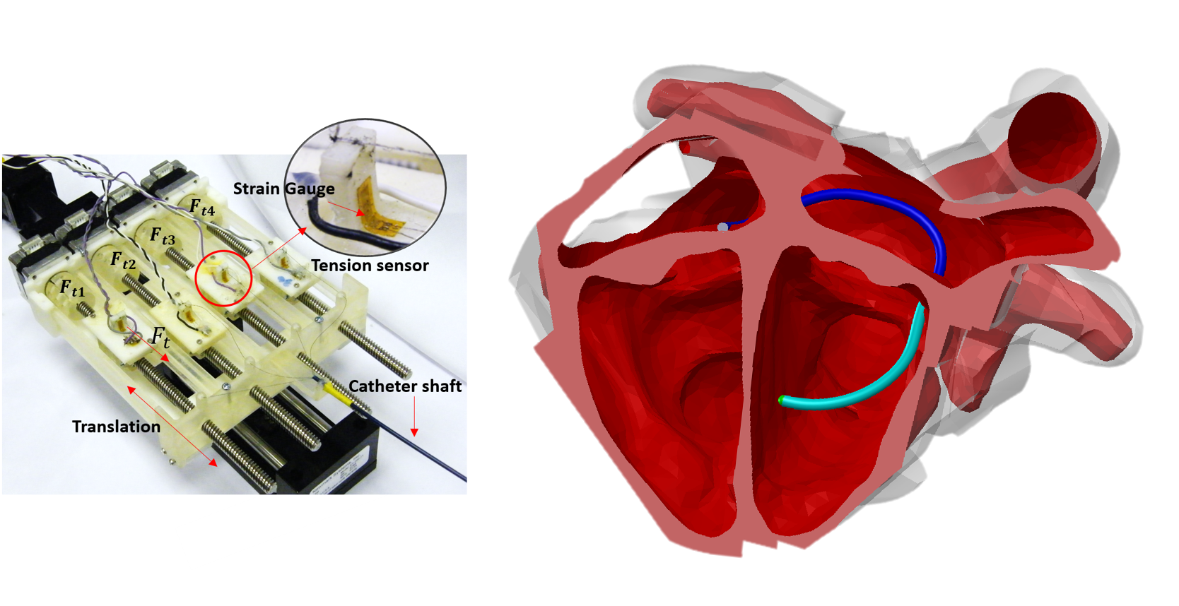 kcl catheter robot