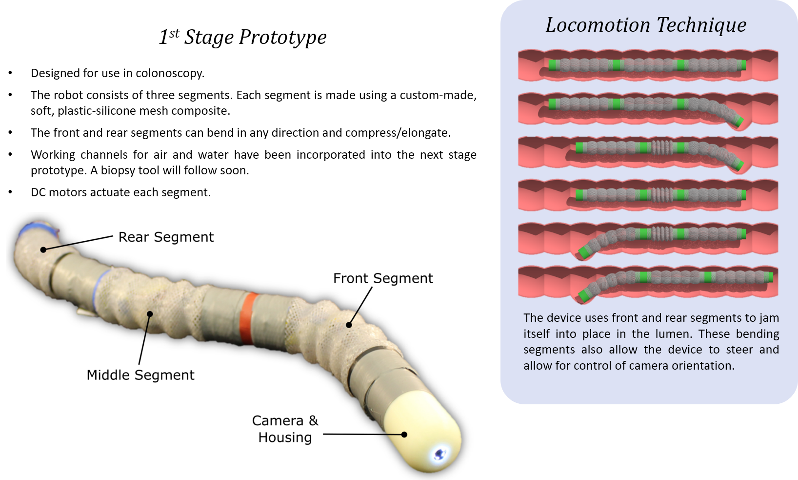 KCL worm colonoscope